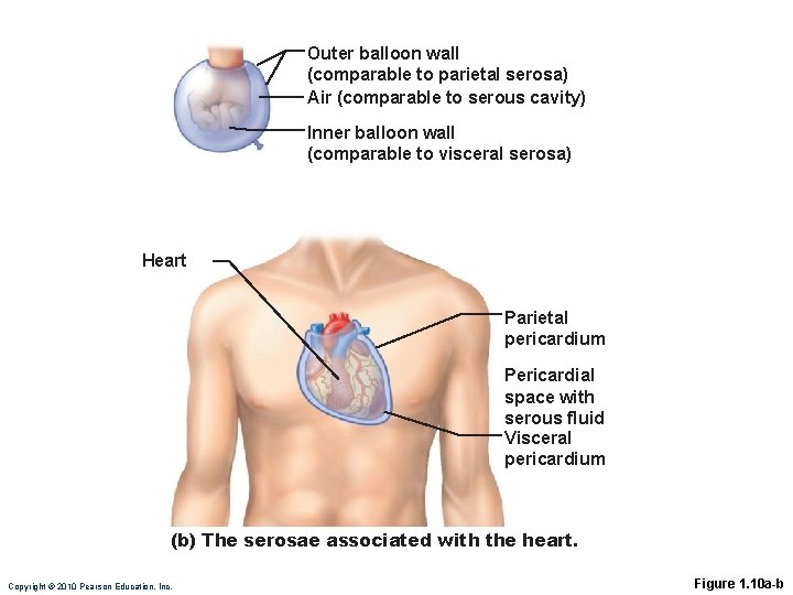 Outer balloon wall (comparable to parietal serosa) Air (comparable to serous cavity) Inner balloon