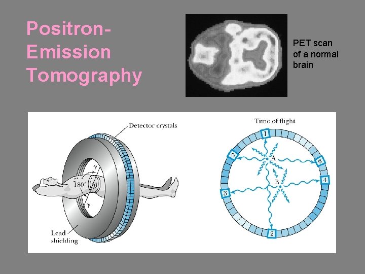 Positron. Emission Tomography PET scan of a normal brain Positron. Emission Tomography PET scan of a normal brain