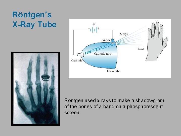 Röntgen’s X-Ray Tube Röntgen used x-rays to make a shadowgram of the bones of Röntgen’s X-Ray Tube Röntgen used x-rays to make a shadowgram of the bones of