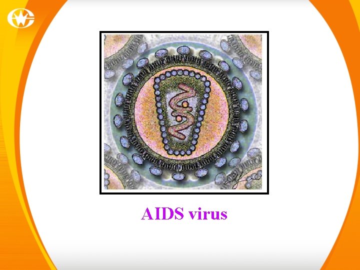 AIDS virus 