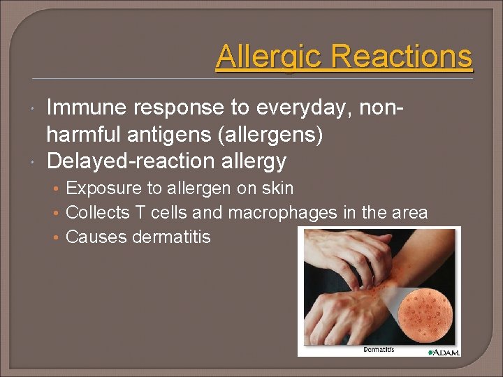 Allergic Reactions Immune response to everyday, nonharmful antigens (allergens) Delayed-reaction allergy • Exposure to
