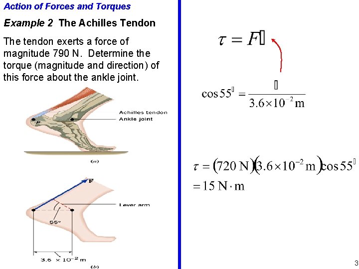 Action of Forces and Torques Example 2 The Achilles Tendon The tendon exerts a