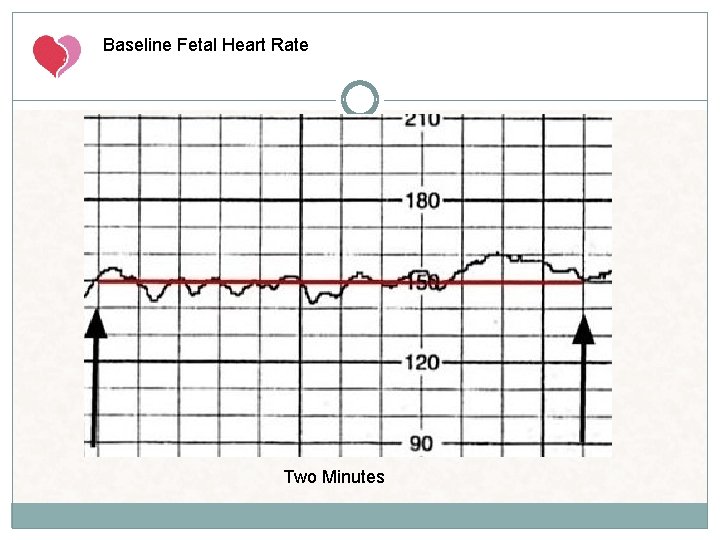 Baseline Fetal Heart Rate Two Minutes Baseline Fetal Heart Rate Two Minutes