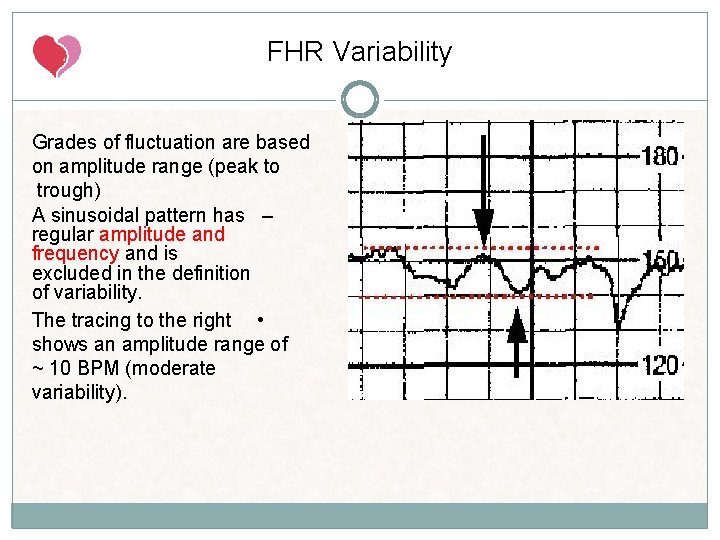 FHR Variability Grades of fluctuation are based on amplitude range (peak to trough) A FHR Variability Grades of fluctuation are based on amplitude range (peak to trough) A
