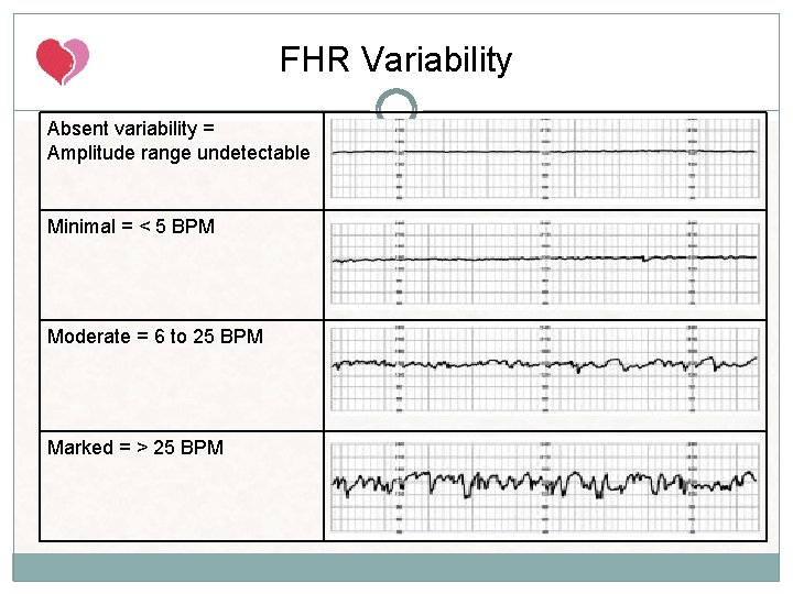 FHR Variability Absent variability = Amplitude range undetectable Minimal = < 5 BPM Moderate FHR Variability Absent variability = Amplitude range undetectable Minimal = < 5 BPM Moderate