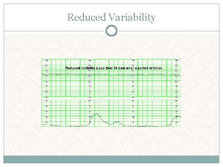 Reduced Variability Reduced Variability