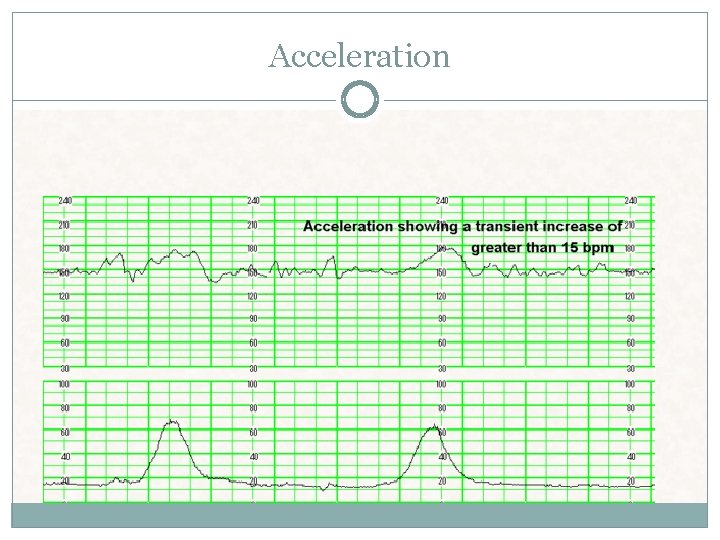 Acceleration Acceleration