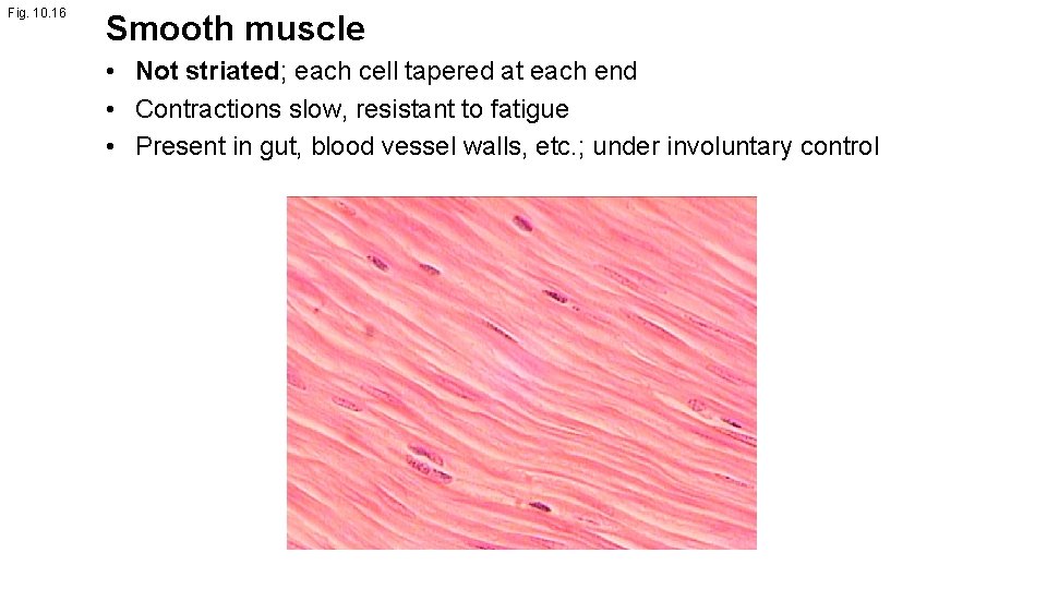 Fig. 10. 16 Smooth muscle • Not striated; each cell tapered at each end