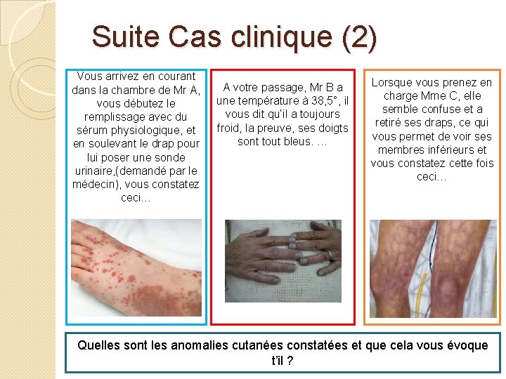  Suite Cas clinique (2) Vous arrivez en courant dans la chambre de Mr