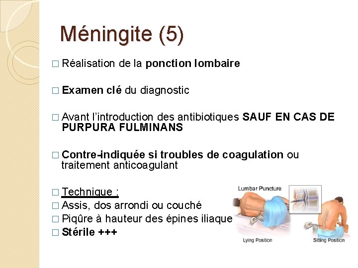 Méningite (5) � Réalisation de la ponction lombaire � Examen clé du diagnostic �