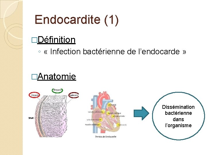 Endocardite (1) �Définition ◦ « Infection bactérienne de l’endocarde » �Anatomie Dissémination bactérienne dans
