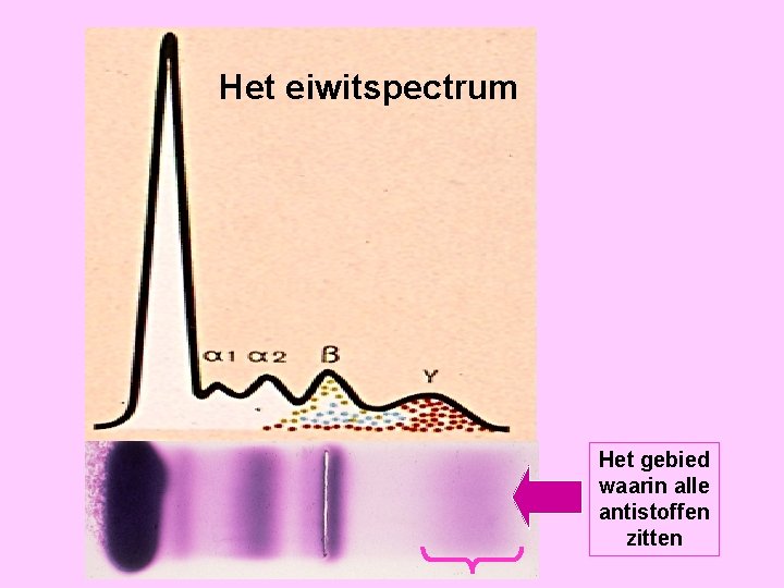 Eiwitspectrum Het eiwitspectrum Het gebied waarin alle antistoffen zitten 