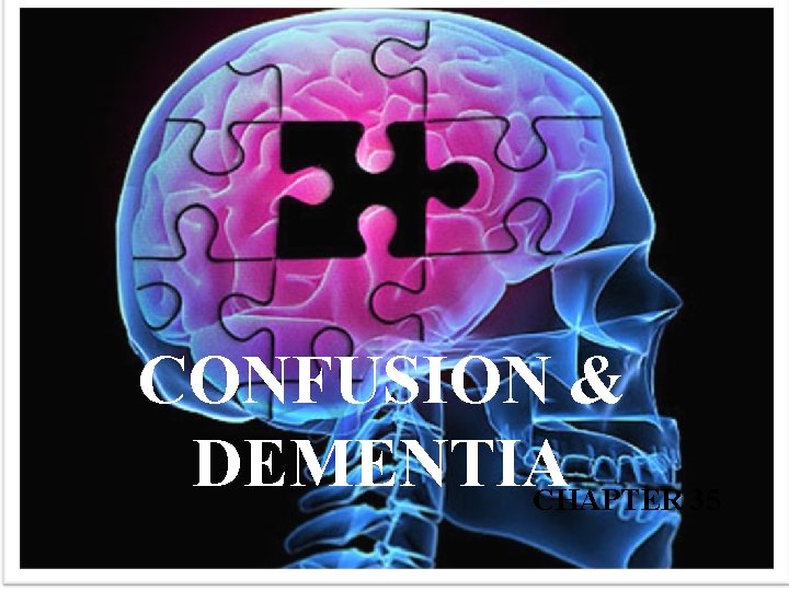 CONFUSION & DEMENTIA CHAPTER 35 