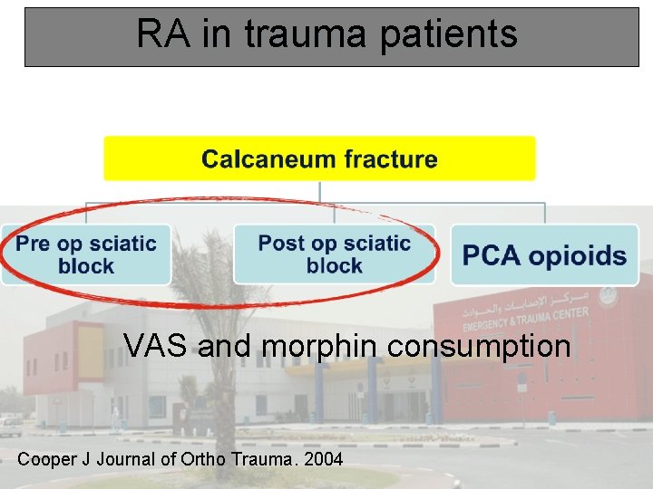 RA in trauma patients VAS and morphin consumption Cooper J Journal of Ortho Trauma.