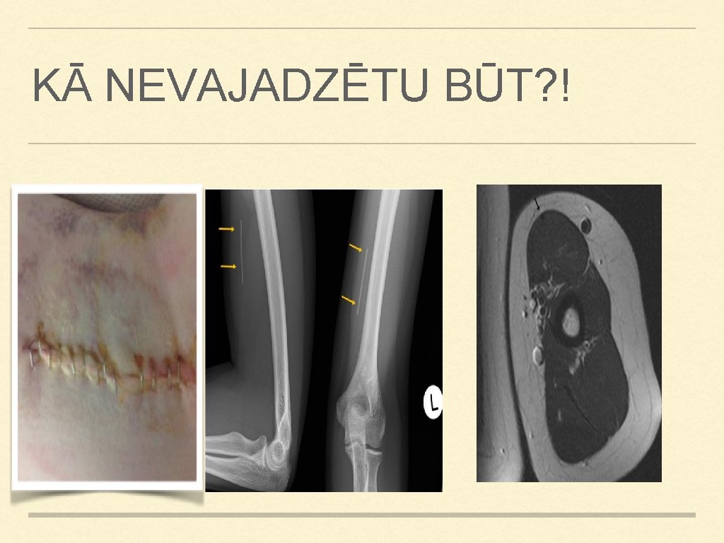 KĀ NEVAJADZĒTU BŪT? ! KĀ NEVAJADZĒTU BŪT? !