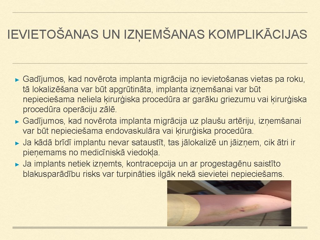 IEVIETOŠANAS UN IZŅEMŠANAS KOMPLIKĀCIJAS ► ► Gadījumos, kad novērota implanta migrācija no ievietošanas vietas IEVIETOŠANAS UN IZŅEMŠANAS KOMPLIKĀCIJAS ► ► Gadījumos, kad novērota implanta migrācija no ievietošanas vietas