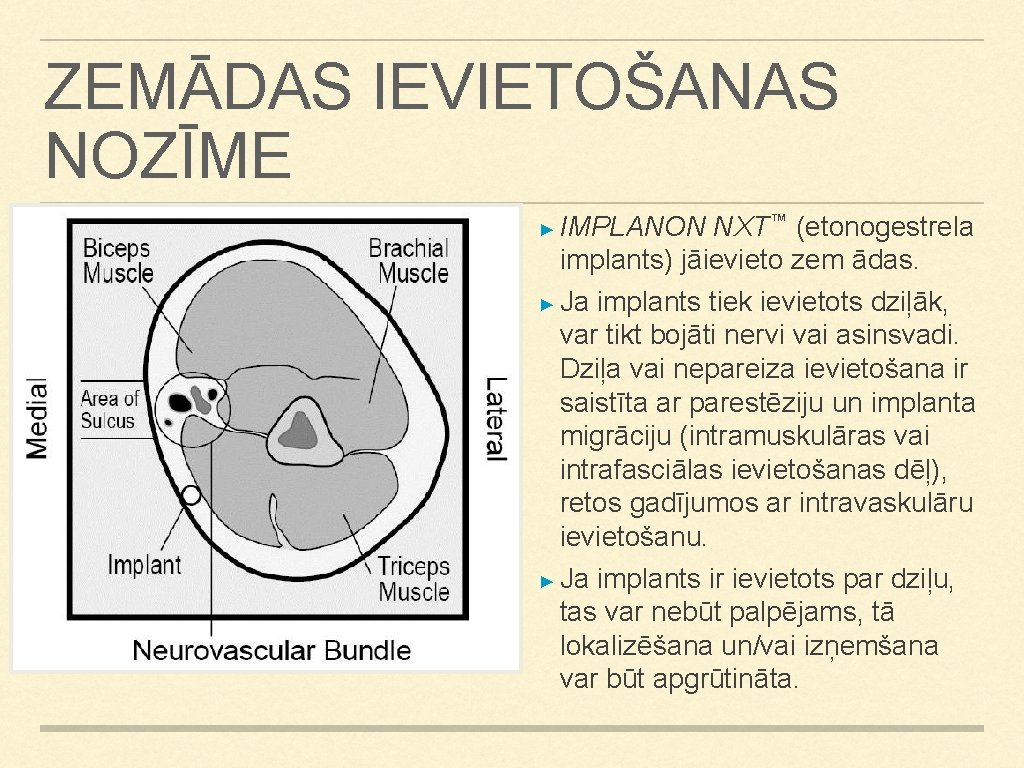 ZEMĀDAS IEVIETOŠANAS NOZĪME ► IMPLANON NXT™ (etonogestrela implants) jāievieto zem ādas. ► Ja implants ZEMĀDAS IEVIETOŠANAS NOZĪME ► IMPLANON NXT™ (etonogestrela implants) jāievieto zem ādas. ► Ja implants