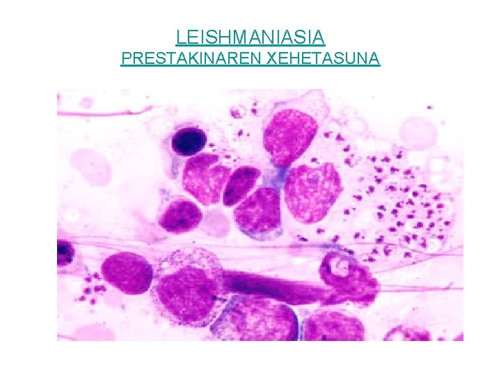 LEISHMANIASIA PRESTAKINAREN XEHETASUNA 