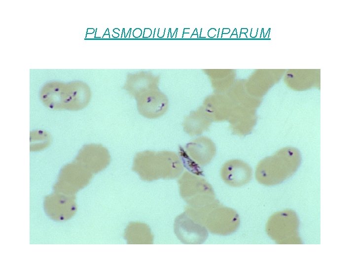 PLASMODIUM FALCIPARUM 