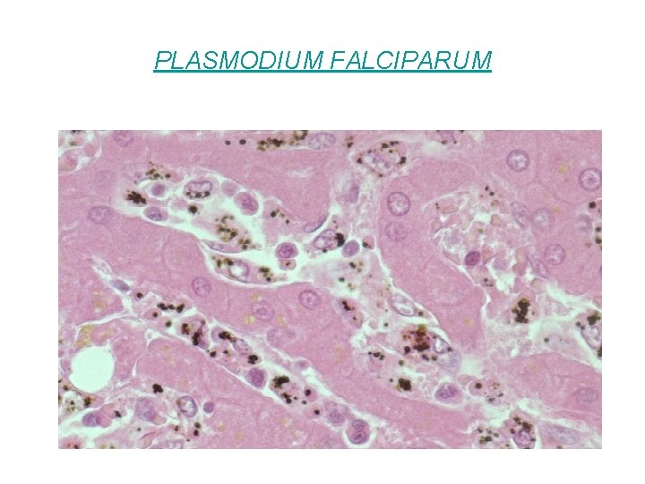 PLASMODIUM FALCIPARUM 