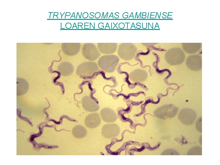 TRYPANOSOMAS GAMBIENSE LOAREN GAIXOTASUNA 