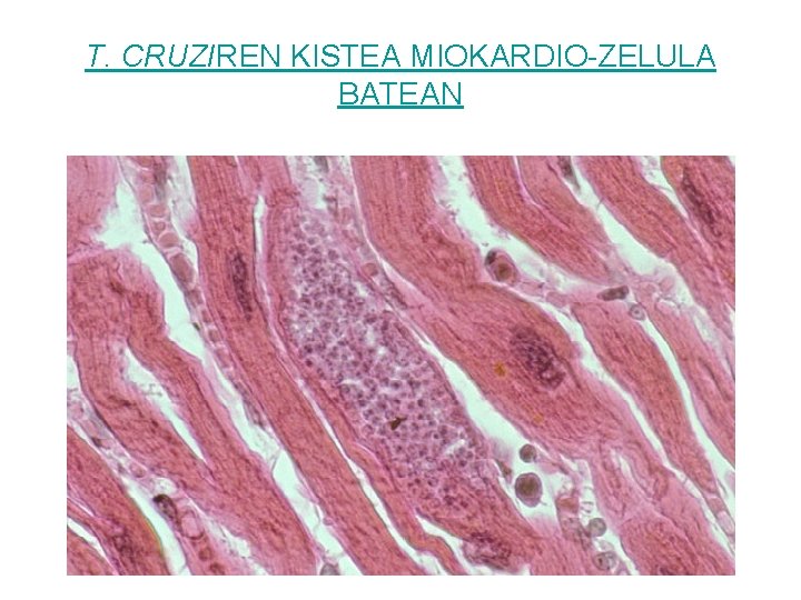 T. CRUZIREN KISTEA MIOKARDIO-ZELULA BATEAN 