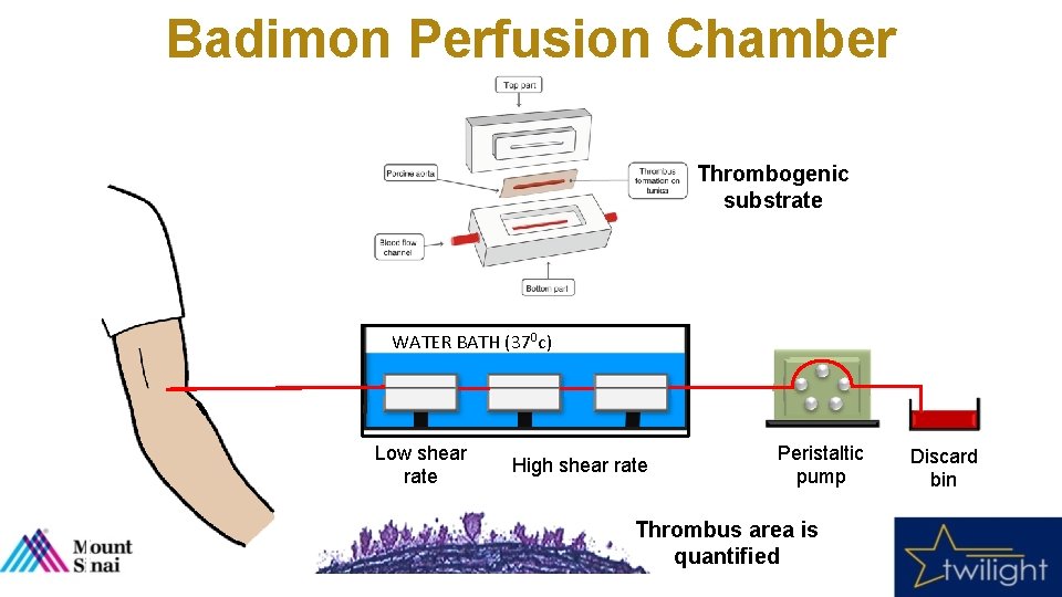 Badimon Perfusion Chamber Thrombogenic substrate WATER BATH (370 c) Low shear rate High shear