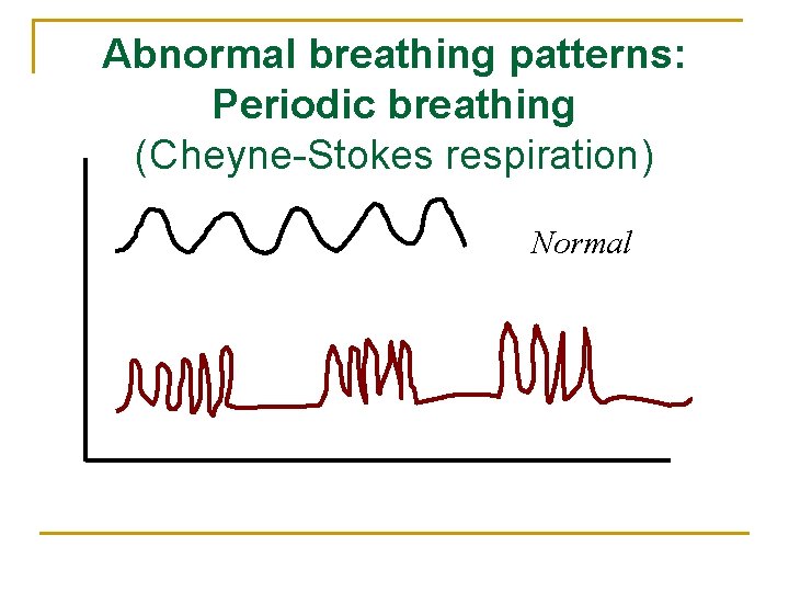 Abnormal breathing patterns: Periodic breathing (Cheyne-Stokes respiration) Normal 