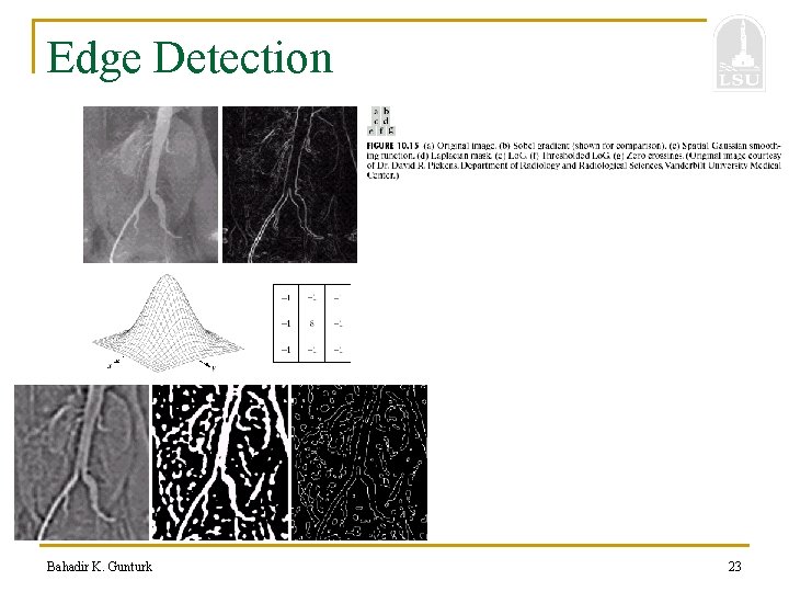 Edge Detection Bahadir K. Gunturk 23 