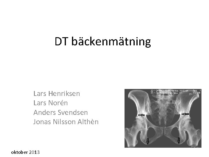 DT bäckenmätning Lars Henriksen Lars Norén Anders Svendsen Jonas Nilsson Althèn oktober 2013 