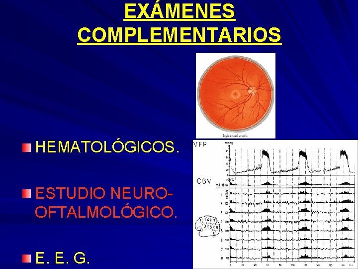 EXÁMENES COMPLEMENTARIOS HEMATOLÓGICOS. ESTUDIO NEUROOFTALMOLÓGICO. E. E. G. 