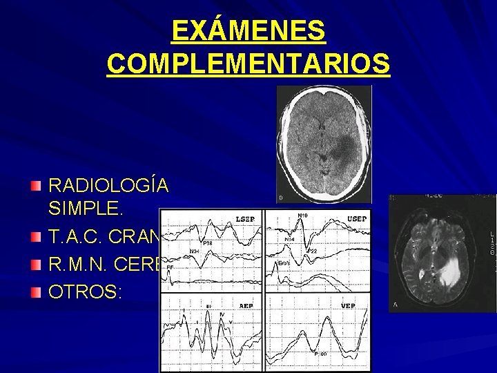 EXÁMENES COMPLEMENTARIOS RADIOLOGÍA SIMPLE. T. A. C. CRANEO. R. M. N. CEREBRO. OTROS: 