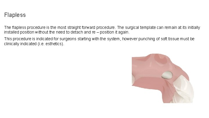 Flapless The flapless procedure is the most straight forward procedure. The surgical template can