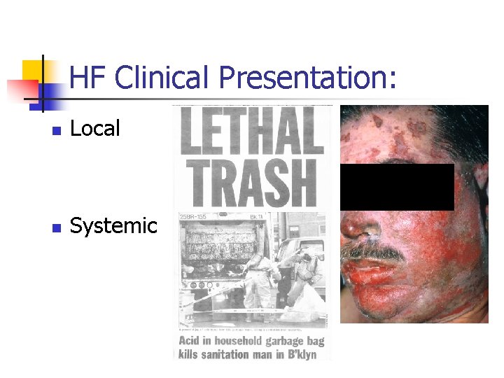 HF Clinical Presentation: n Local n Systemic 