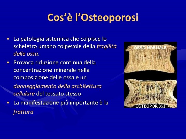 Cos’è l’Osteoporosi • La patologia sistemica che colpisce lo scheletro umano colpevole della fragilità