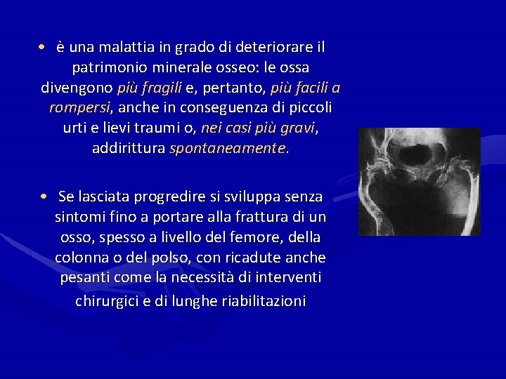  • è una malattia in grado di deteriorare il patrimonio minerale osseo: le