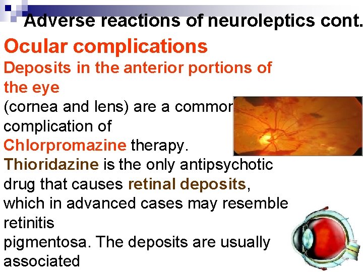 Adverse reactions of neuroleptics cont. Ocular complications Deposits in the anterior portions of the