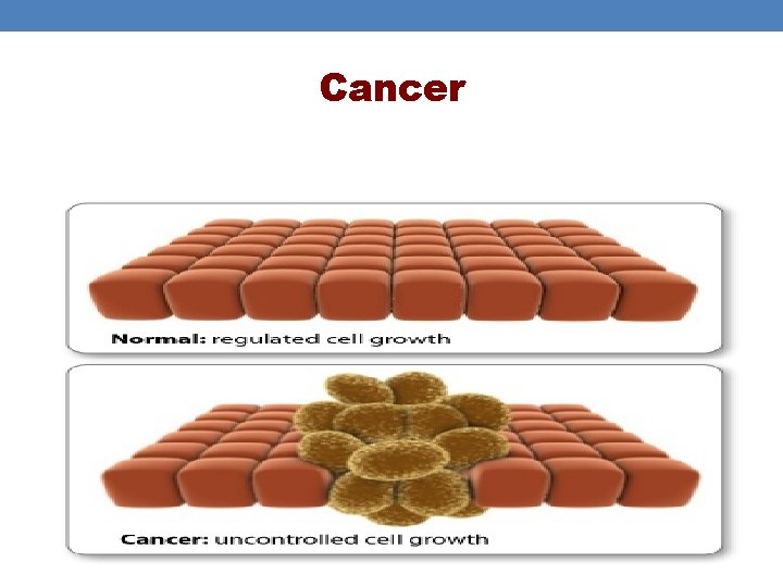 Cancer Cancer