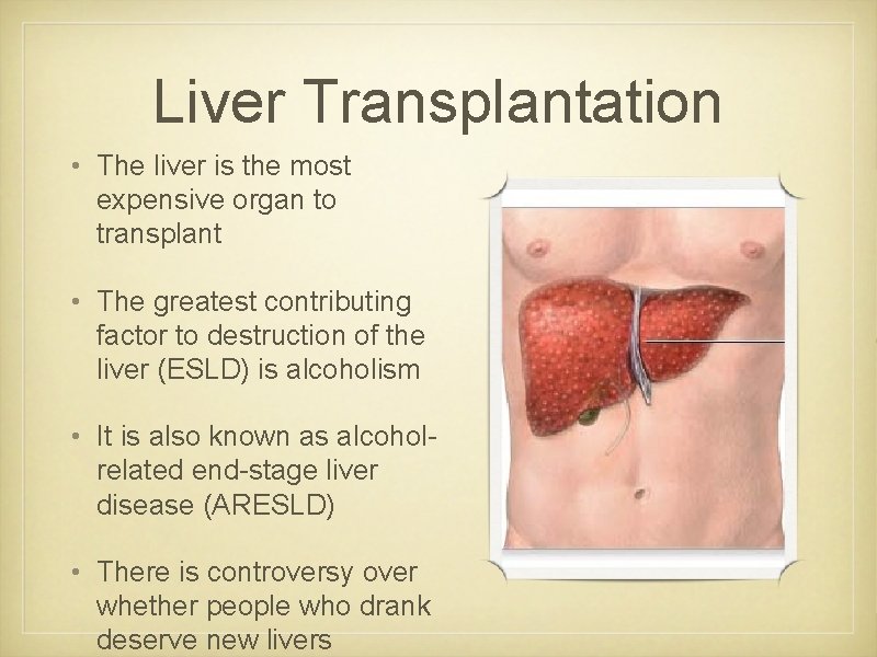 Liver Transplantation • The liver is the most expensive organ to transplant • The