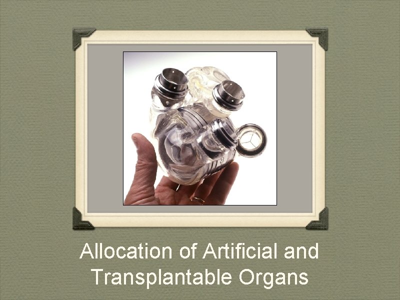 Allocation of Artificial and Transplantable Organs 