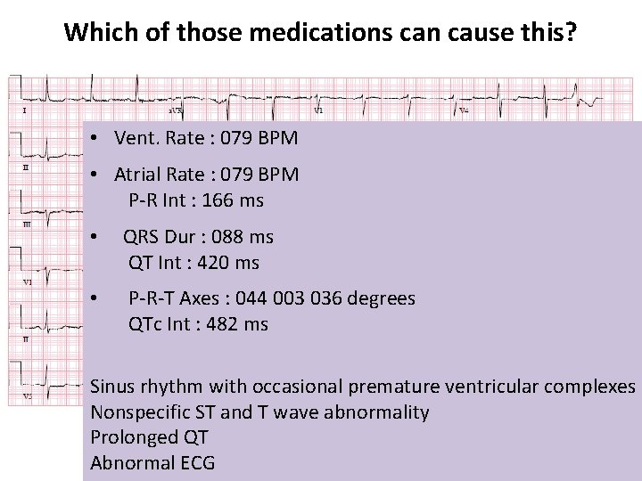 Which of those medications can cause this? • Vent. Rate : 079 BPM •