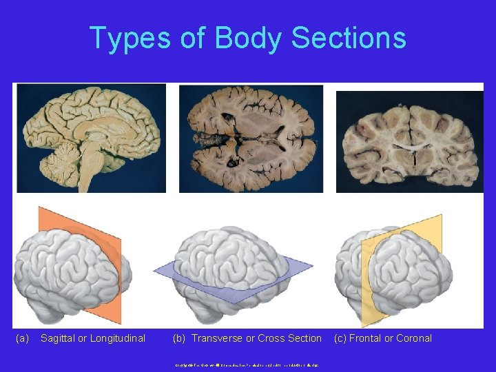 Types of Body Sections (a) Sagittal or Longitudinal (b) Transverse or Cross Section Copyright