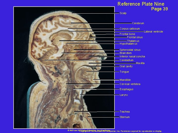 Reference Plate Nine Page 39 Scalp Plate 1. 9 Cerebrum Corpus callosum Frontal bone