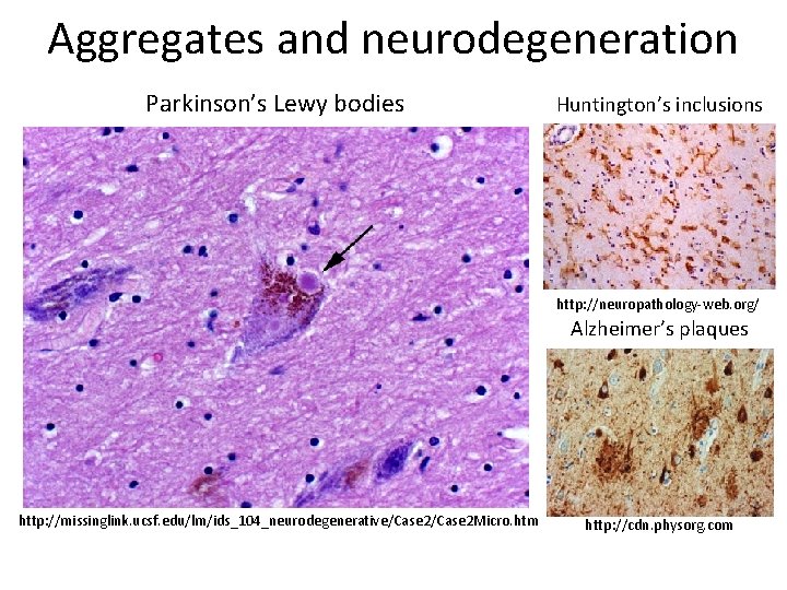 Aggregates and neurodegeneration Parkinson’s Lewy bodies Huntington’s inclusions http: //neuropathology-web. org/ Alzheimer’s plaques http: