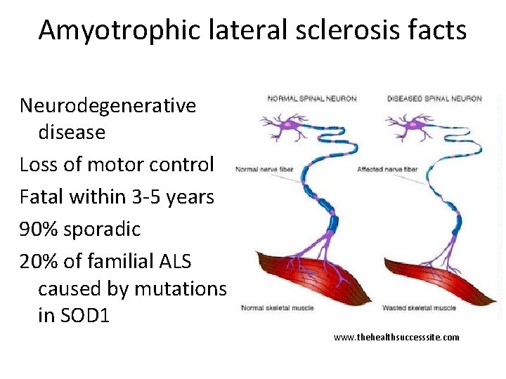 Amyotrophic lateral sclerosis facts Neurodegenerative disease Loss of motor control Fatal within 3 -5