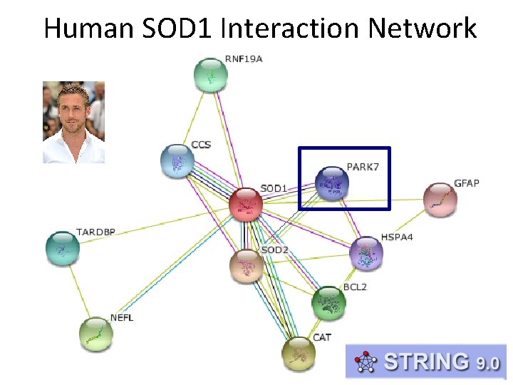 Human SOD 1 Interaction Network 