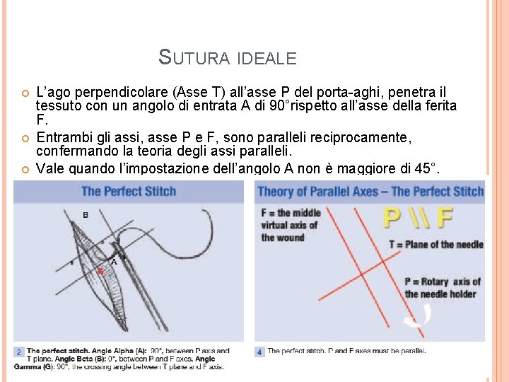 SUTURA IDEALE L’ago perpendicolare (Asse T) all’asse P del porta-aghi, penetra il tessuto con