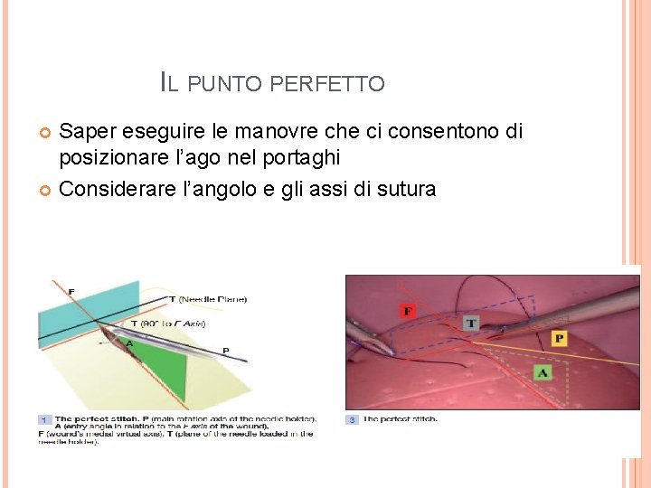 IL PUNTO PERFETTO Saper eseguire le manovre che ci consentono di posizionare l’ago nel