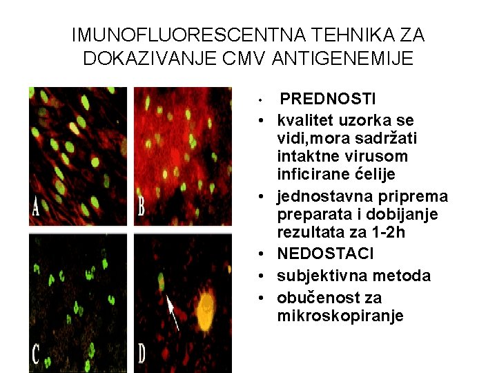 IMUNOFLUORESCENTNA TEHNIKA ZA DOKAZIVANJE CMV ANTIGENEMIJE • • • PREDNOSTI kvalitet uzorka se vidi,