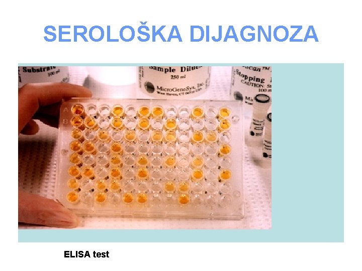 SEROLOŠKA DIJAGNOZA ELISA TEST ELISA test 